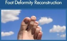 Foot Deformity Reconstruction - Mr Htwe Zaw - Foot and Ankle Surgeon
